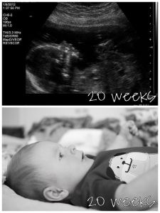 tehotenstvo týždeň po týždni